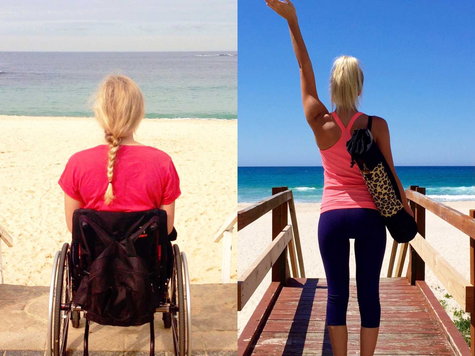 Side by side of paraplegic woman in wheelchair at beach then her standing in same location after therapy