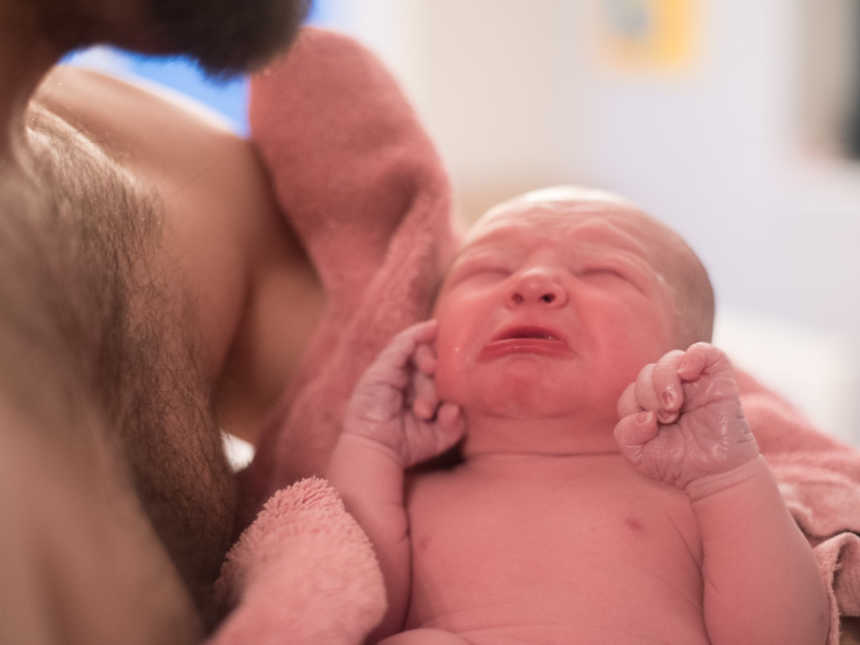 Newborn who was encapsulated in sac at birth is held in shirtless father's arms