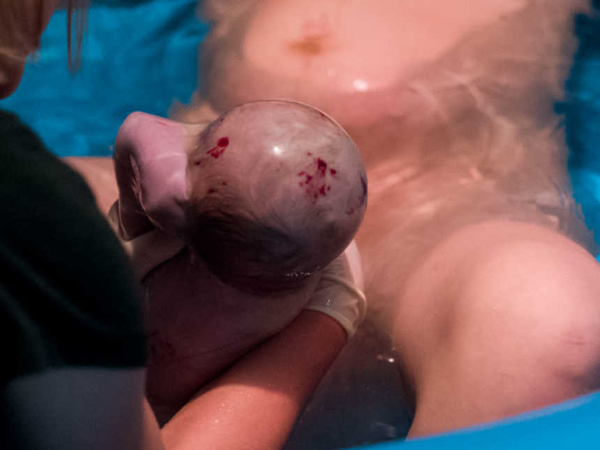 Midwife holds newborn baby who is still encapsulated in his sac