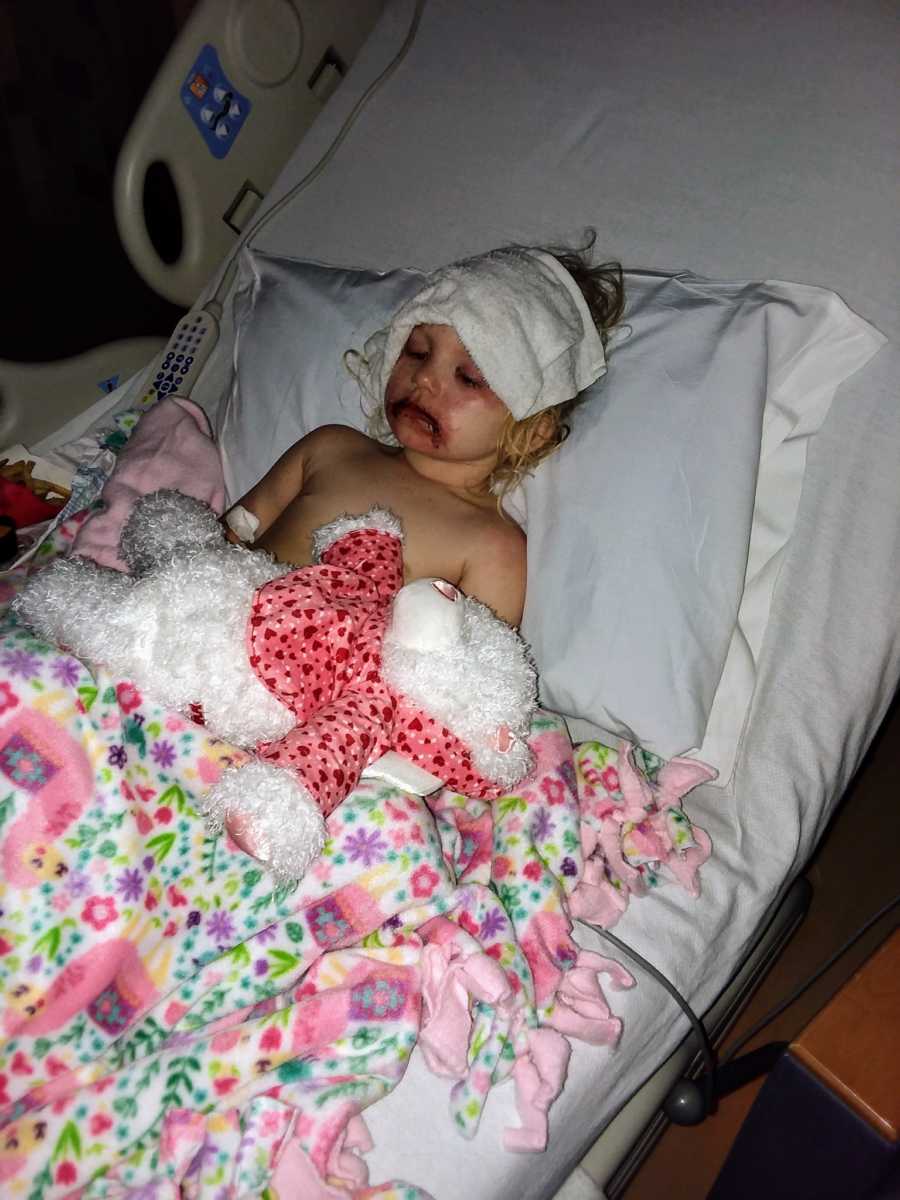 Toddler whose face blistered from makeup kit lies in hospital bed with colorful blankets and stuffed animals