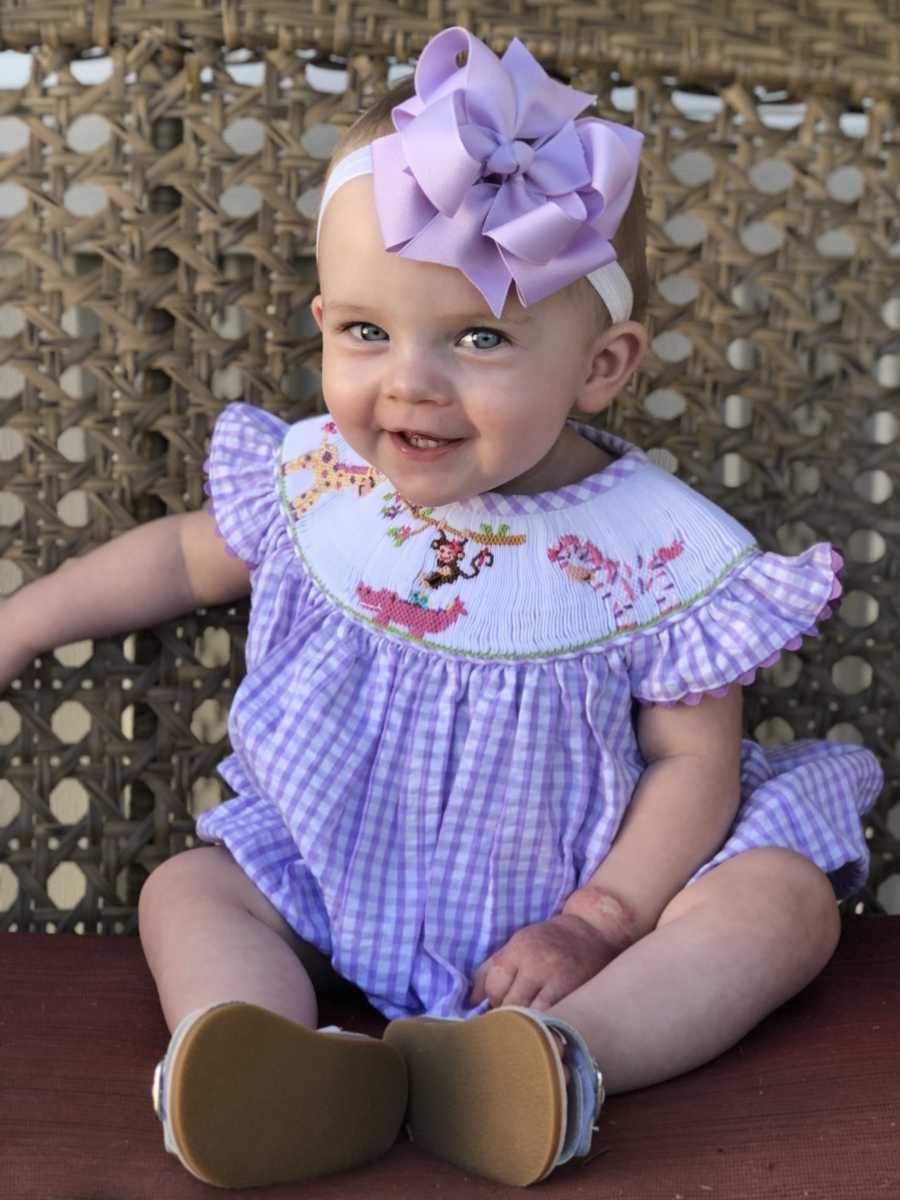 Little girl who was two pounds at birth sits smiling in chair with big purple bow on top of her head