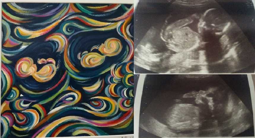 Ultrasound painting of twins done by woman who once was a lawyer
