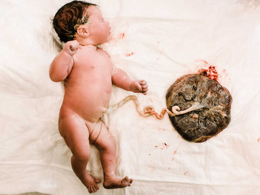 Aerial view of newborn with umbilical chord still attached lying next to placenta