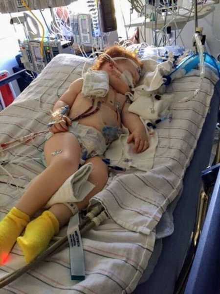 Toddler after open heart surgery lying in hospital bed connected to machines