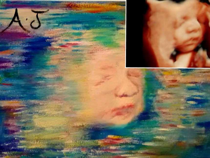Painting of ultrasound by a woman who once was a lawyer