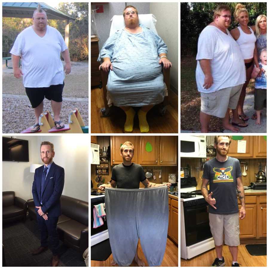 Collage of 500 pound man before and after gastric bypass surgery and losing 350 pounds