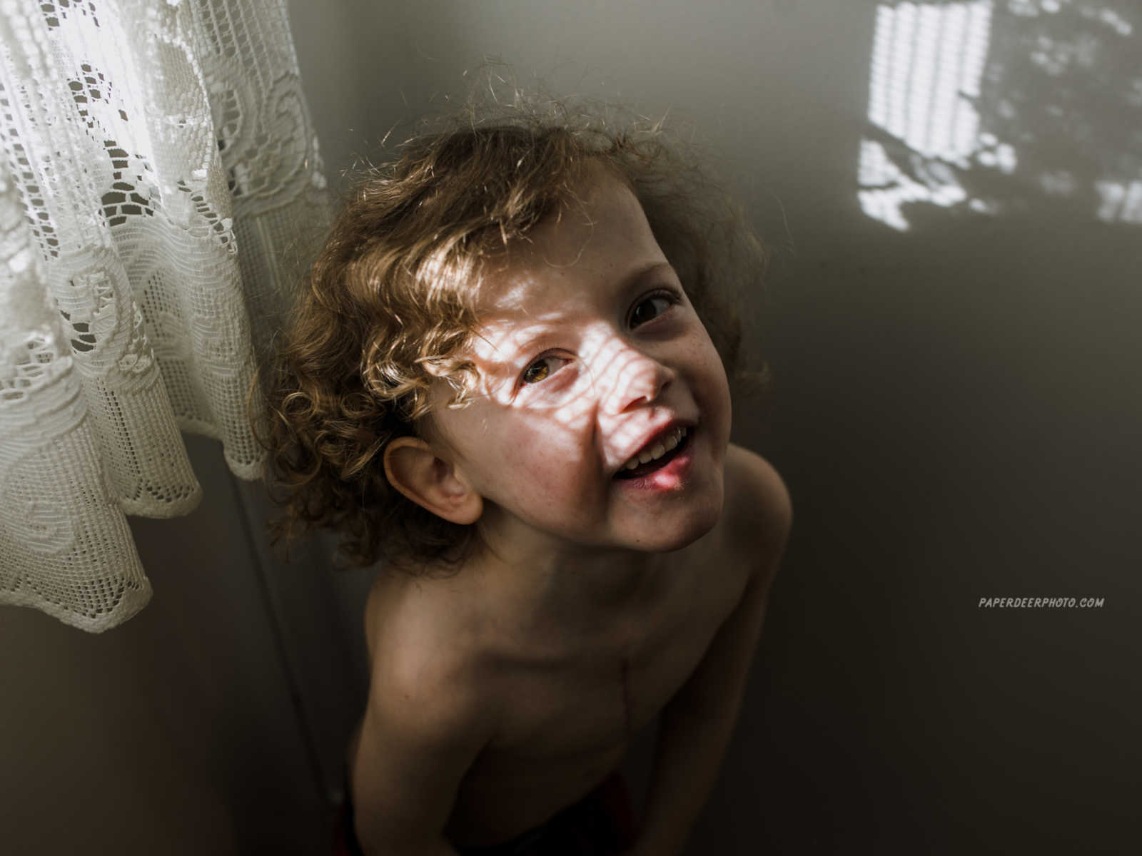 Four year old who has had three heart surgeries looks up smiling 