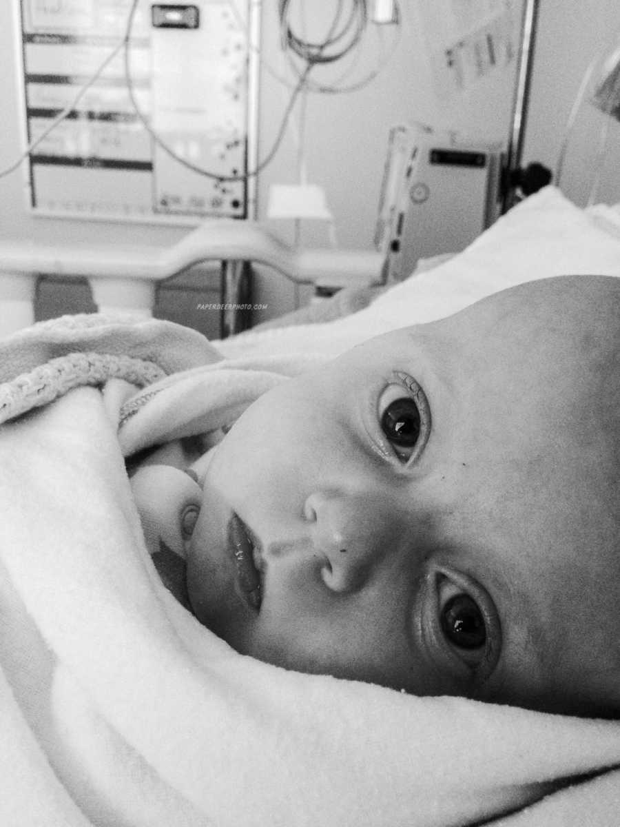Close up of baby's face in hospital bed before second hear surgery