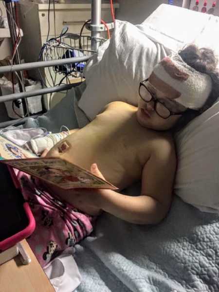 Little girl lies shirtless in hospital bed with bandage wrapped around her head reading a book after brain surgery 