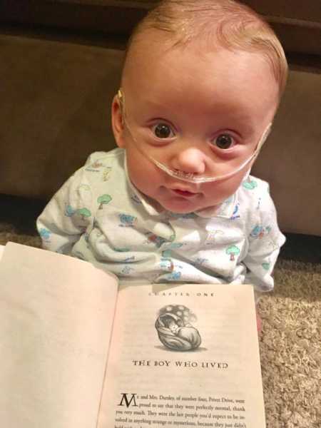 Baby who fought all odds to live sits with oxygen up is nose and Harry Potter book in front of him