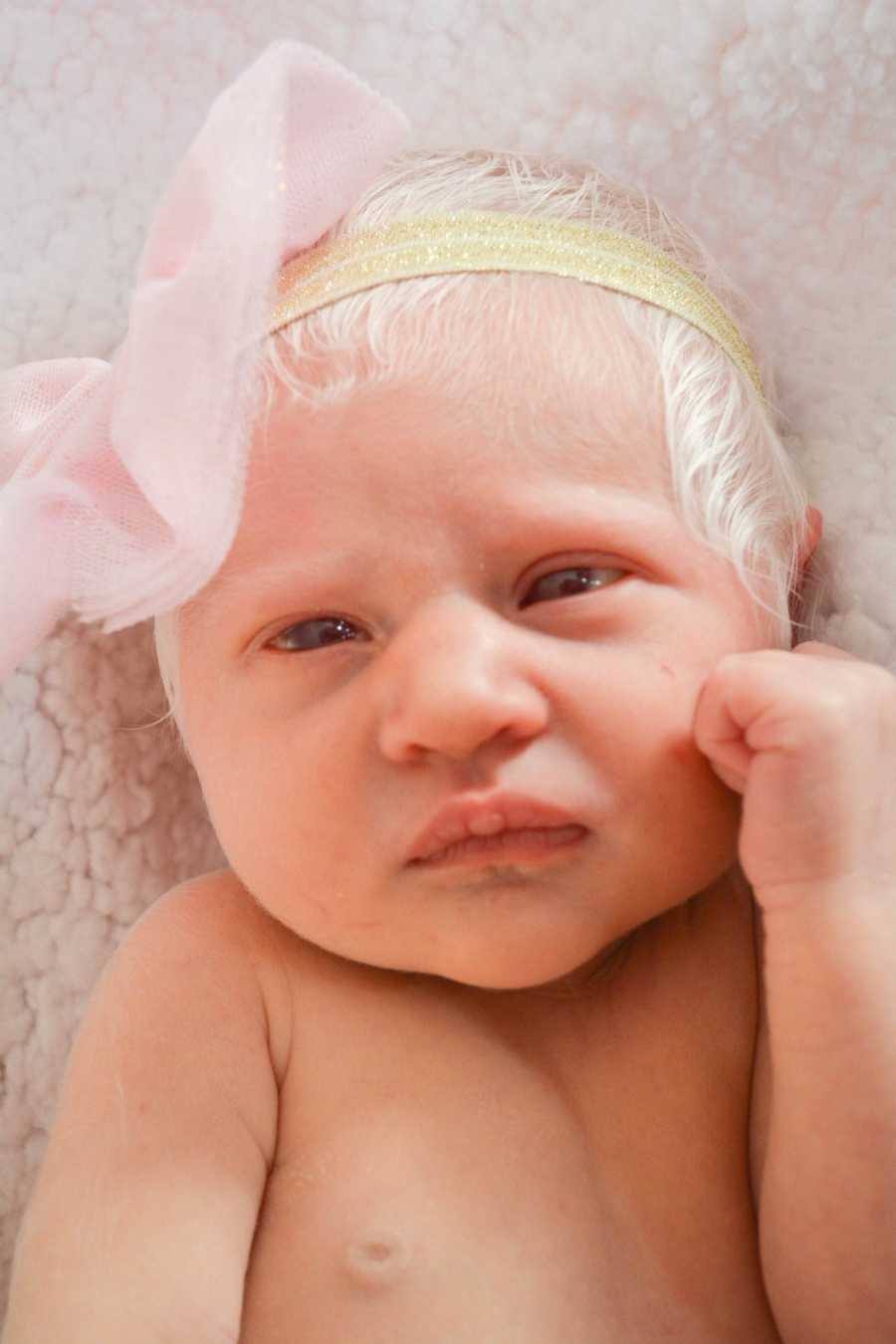 Close up of albino baby with bright white hair wearing headband with pink bow