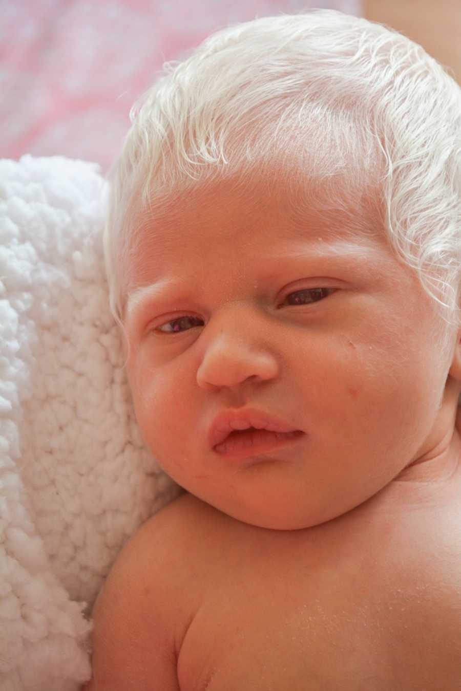 Close up of albino newborn with bright white hair