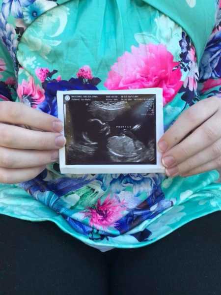 Close up of woman holding ultrasound in front of her stomach