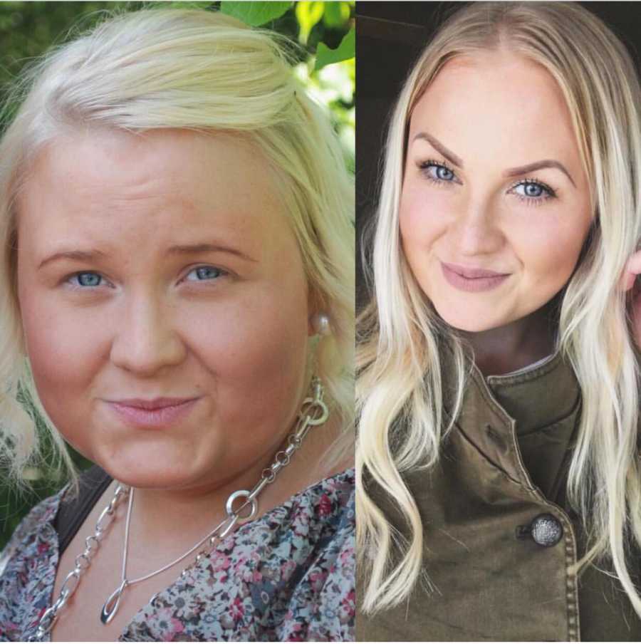 Close up of girlfriend face before and after losing weight 