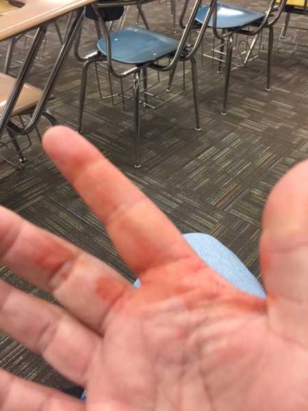 Close up of teachers hand that has fake blood on it during shooter drill