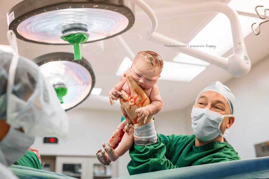 Doctor holds up newborn baby in air after c-section