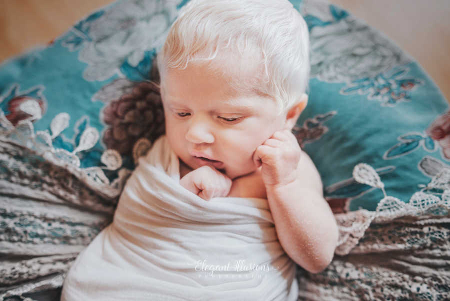 Albino newborn with bright white hair swaddled in blanket