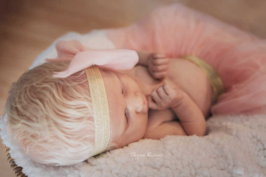 Albino newborn with bright white hair lays in pink tutu and headband with pink bow