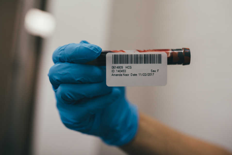 Doctor holding tube of blood from woman who had fertility issues