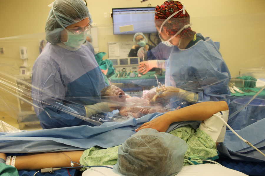 Baby being delivered via c-section while mother watches through clear screen