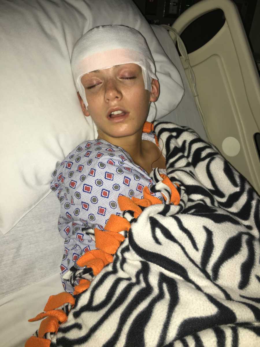 Teen with focal seizures lays asleep in hospital bed with bandage covering her head