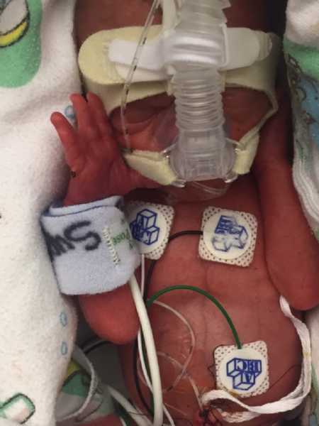 Close up of newborn sleeping in NICU hooked up to oxygen