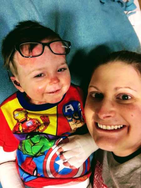 Mother smiles in selfie with toddler son with rare skin disease
