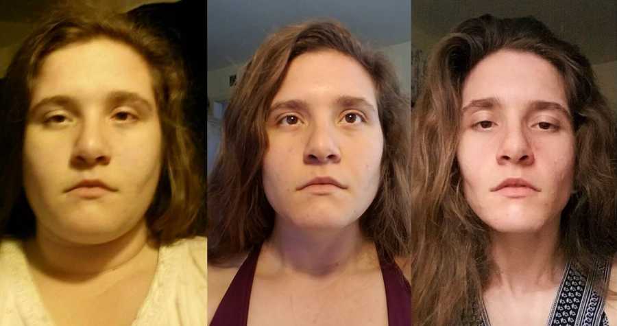 Before during and after of woman's face on weight loss journey