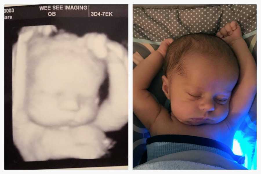 Side by side of baby sleeping the same way he did in ultrasound