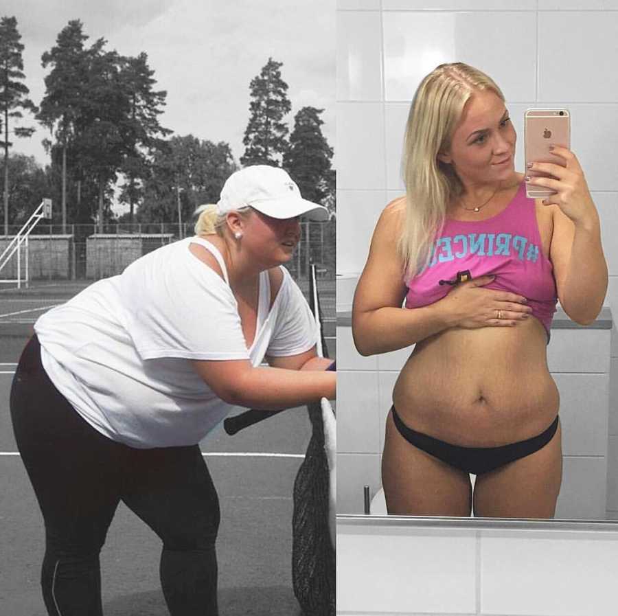 Woman before and after losing weight