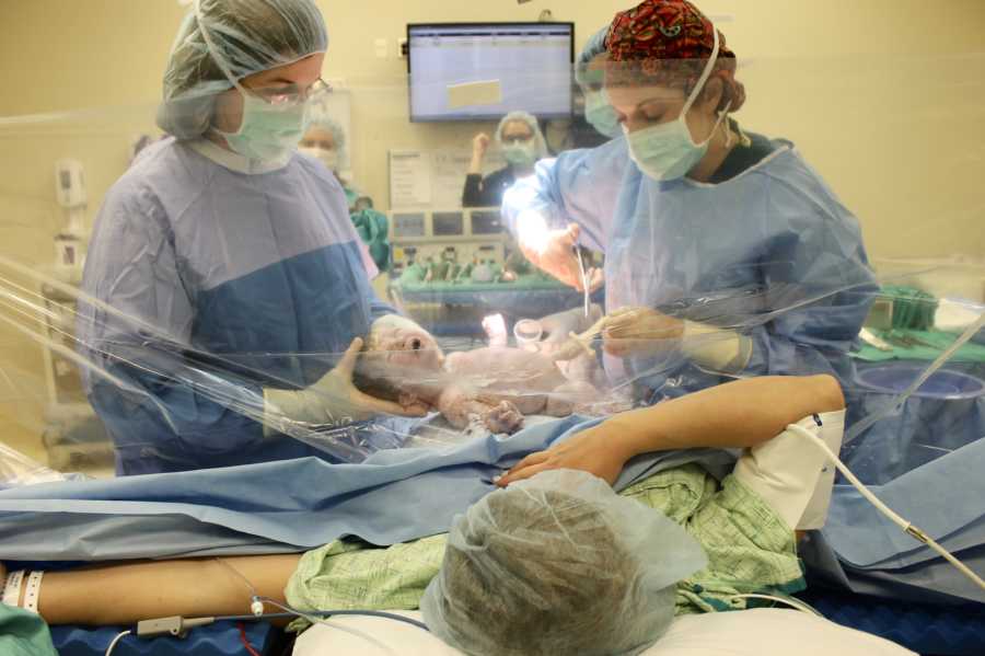 OBGYN's deliver baby via c-section and mother watches through clear screen