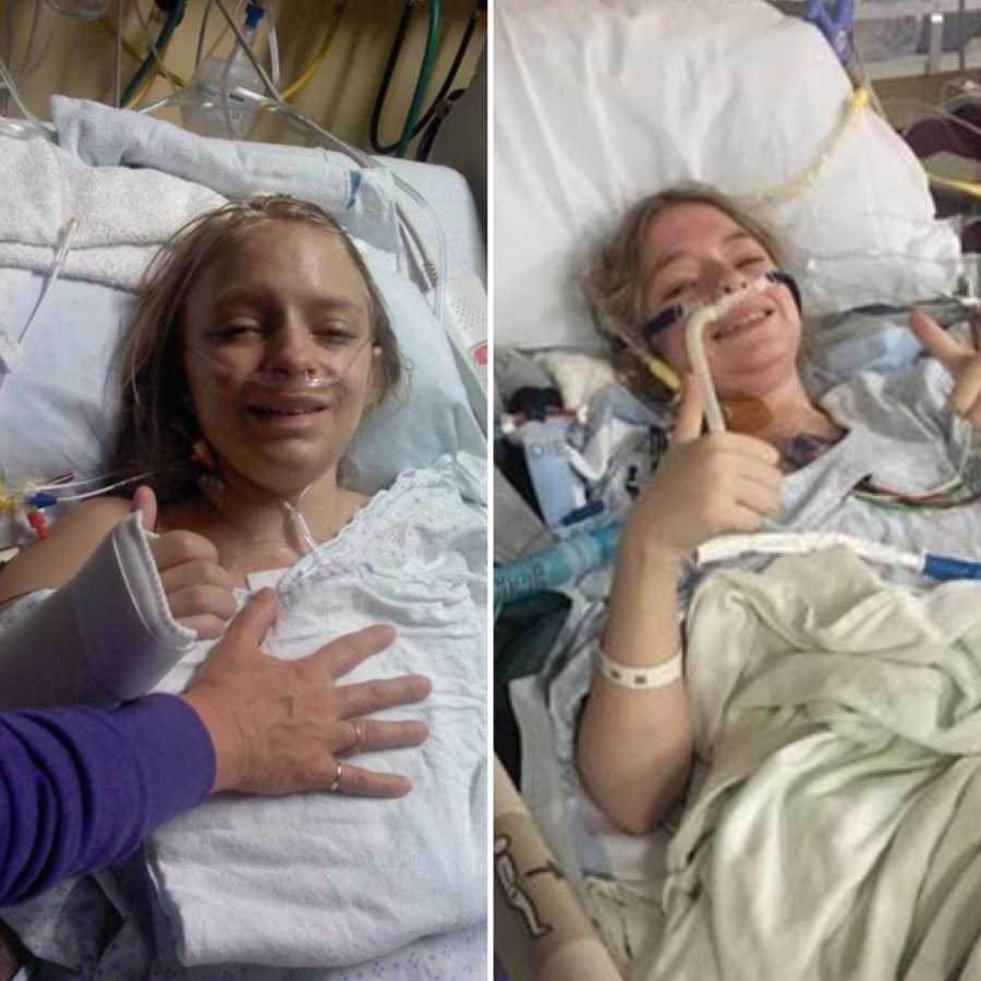 23 year old with cystic fibrosis before and after lung transplant