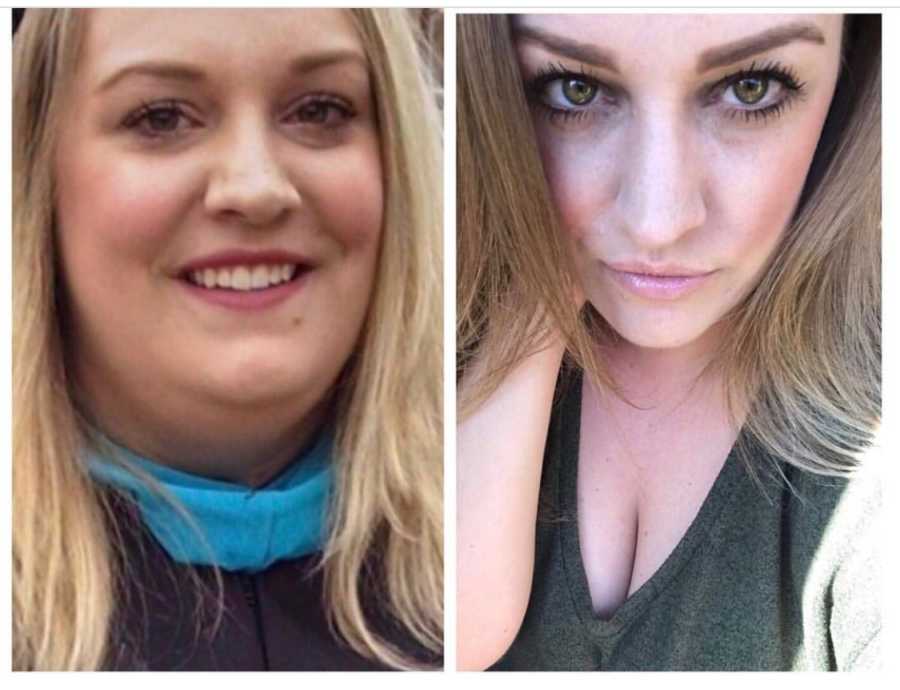 Before and after of woman's face after losing weight