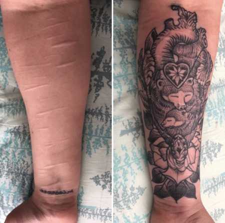 Side by side of woman's arm with scars from when she would cut herself as teen next to arm covered in tattoo