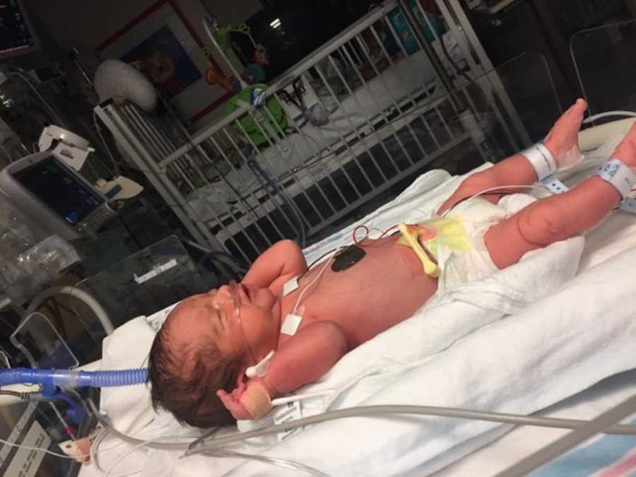 Newborn lays in NICU after having pediatric stroke in womb