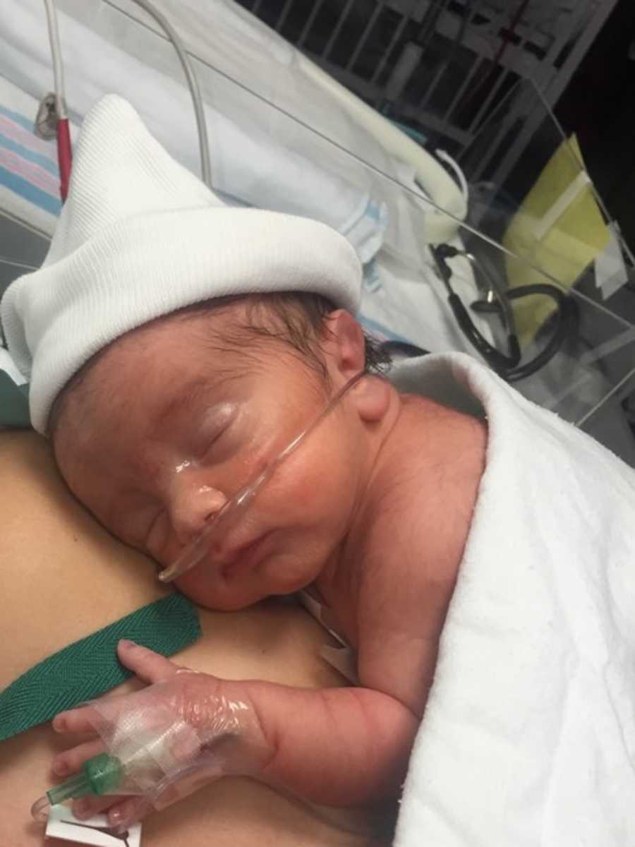 Newborn who had pediatric stroke lies asleep on mother's bare chest