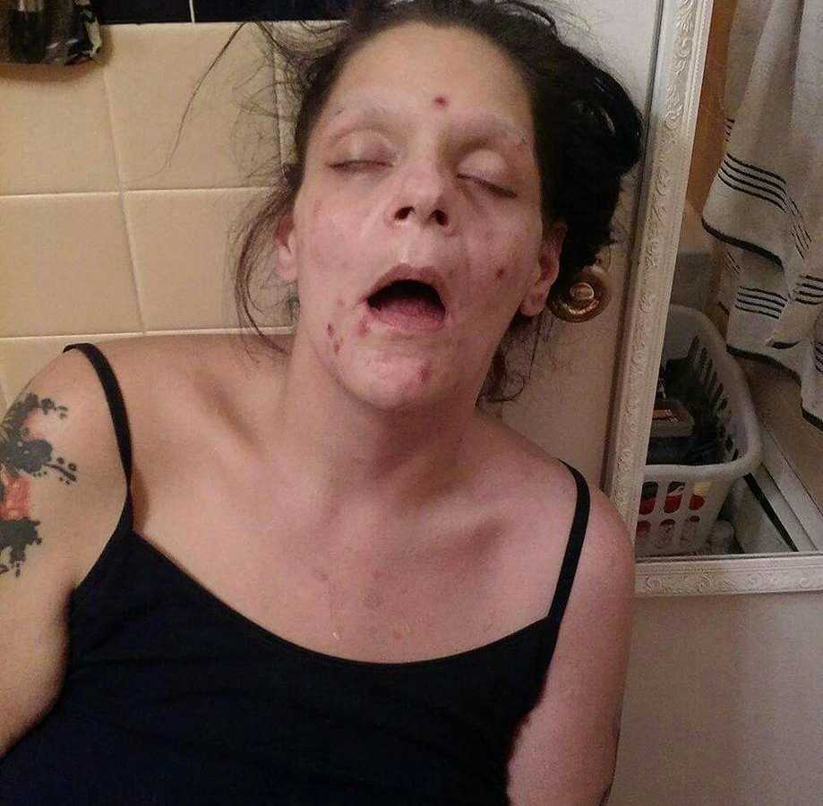 Woman addicted to drugs passed out in bathroom with sores on her face