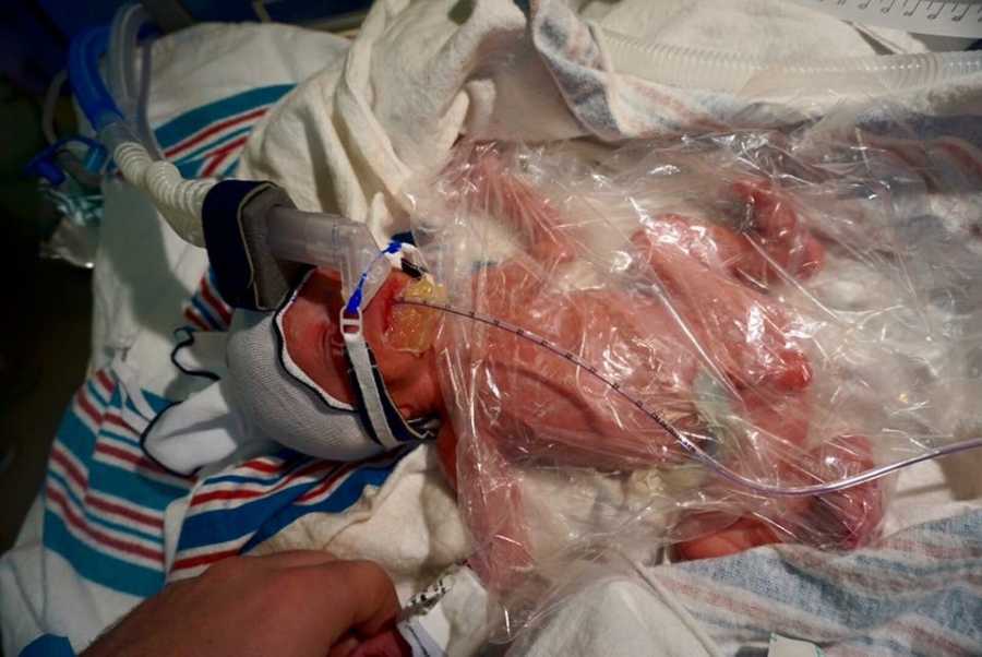 A newborn baby covered in plastic wrap with a breathing tube on their face.