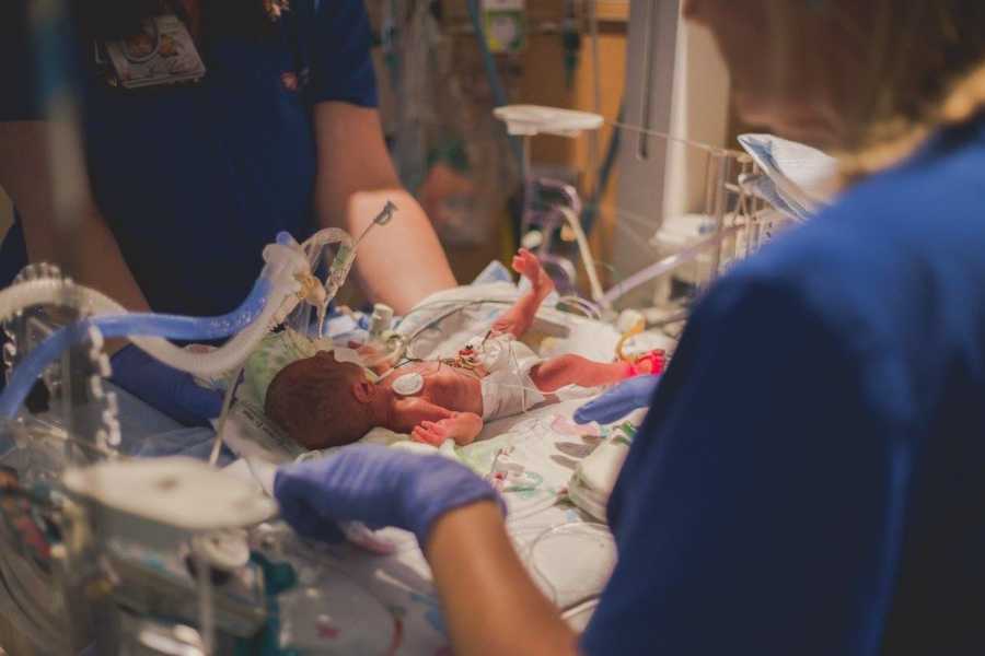 A newborn baby lying on a hospital table with wires attached.