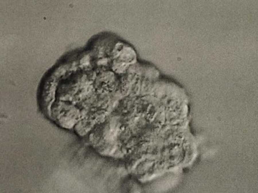 An ultrasound image of a fetus in black and white