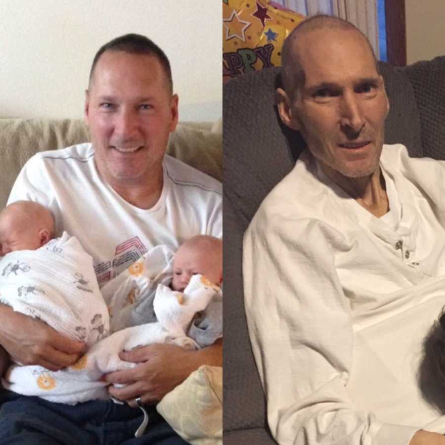 Woman shows before and after photos of her father's declining health from cancer