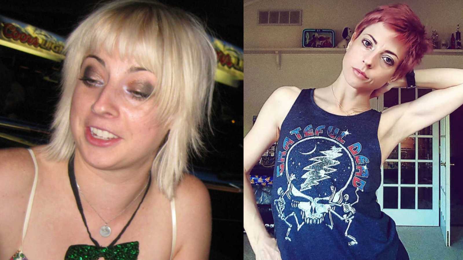 Woman shows difference in appearance from before and after she stopped drinking alcohol