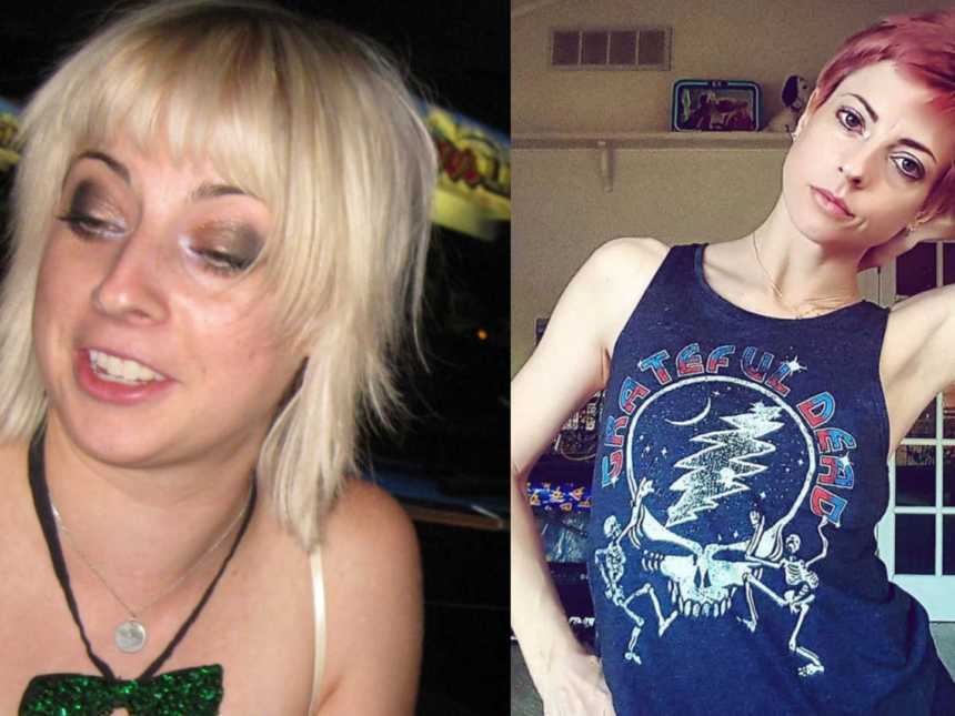 Woman shows difference in appearance from before and after she stopped drinking alcohol