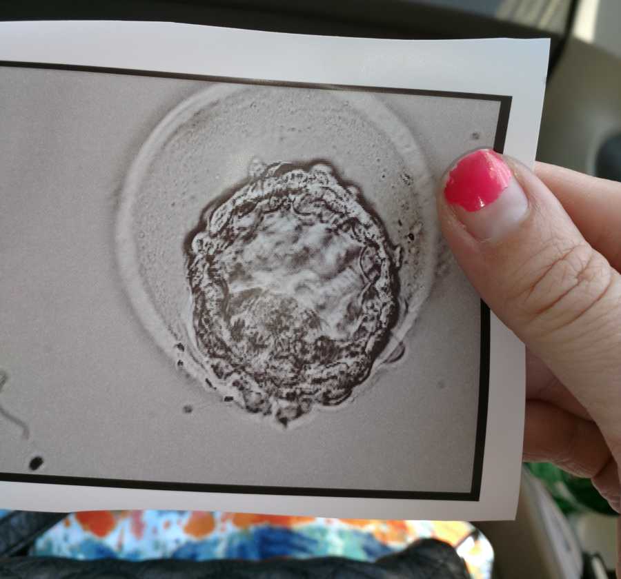 Woman battling infertility takes a photo of an ultrasound of an embryo