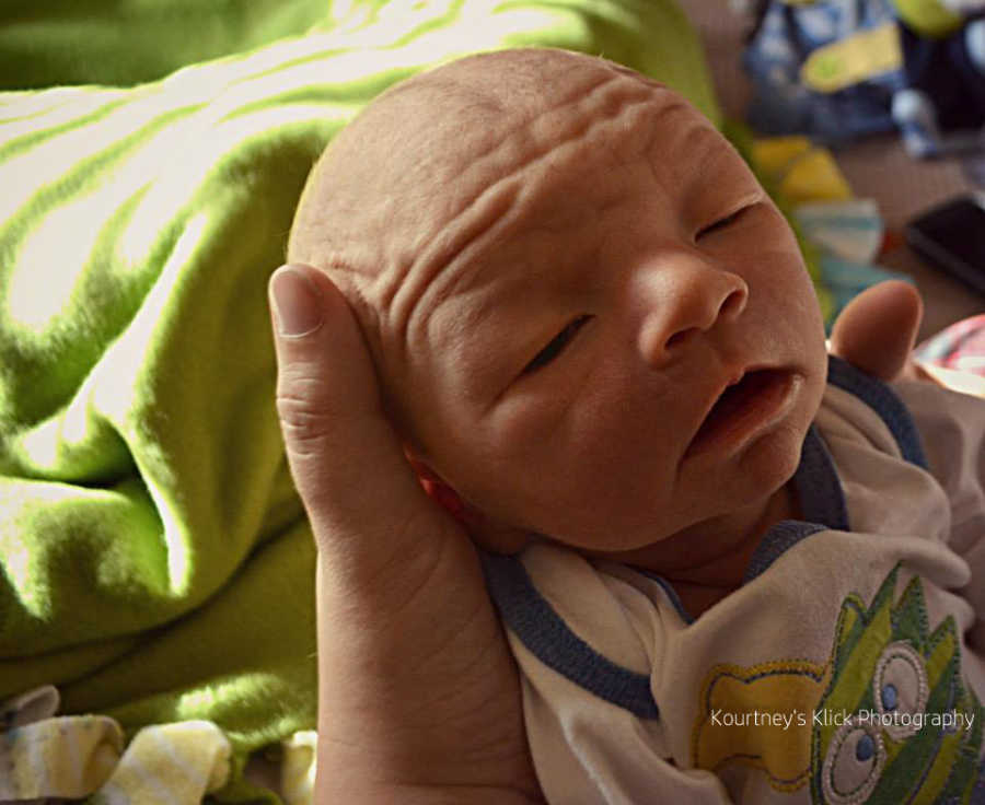 Head of newborn with chromosome 7 inversion's head being held by mother