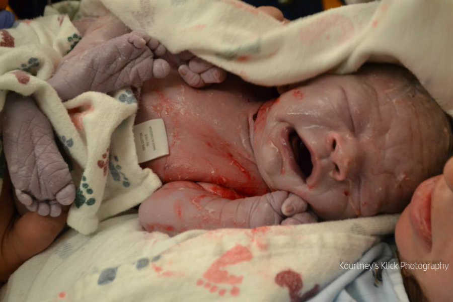 Newborn baby with chromosome 7 inversion crying