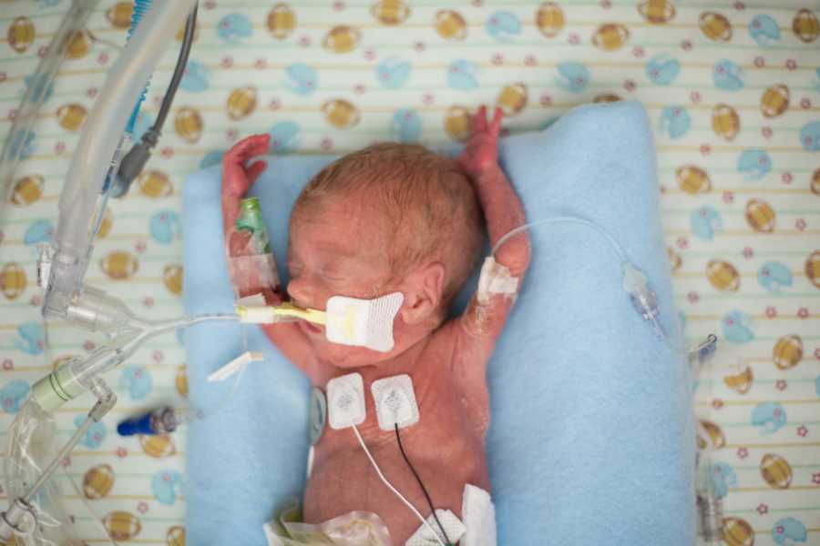 Mom takes a photo of her newborn preemie while he's connected to tubes and wires