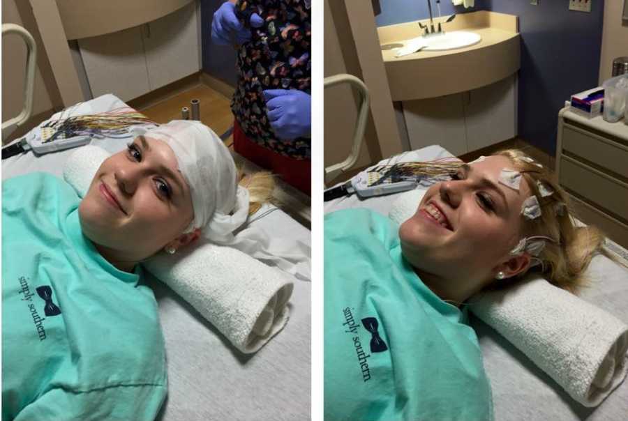 Teen lying in hospital bed with bandage and wires on her head 