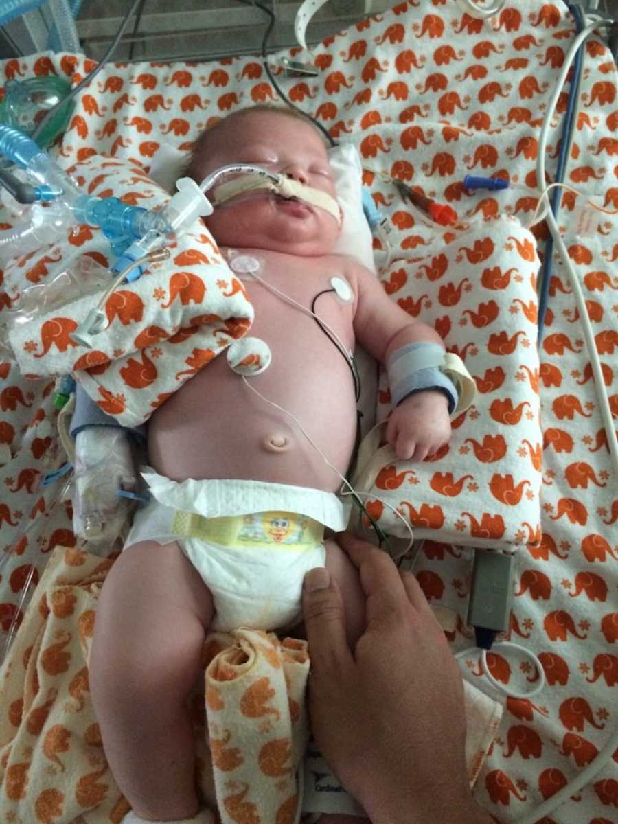 Newborn asleep in NICU who was abandoned by mother