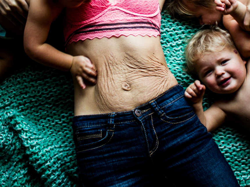 Close up of woman's stomach with extra skin after giving birth to triplets